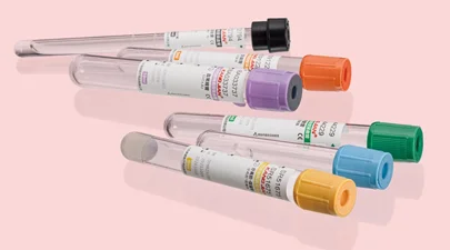 Test tube characteristics